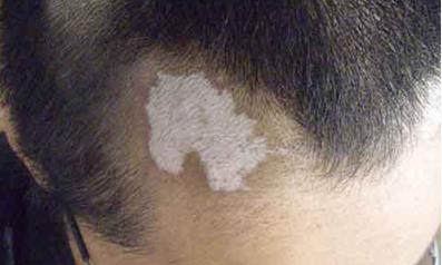 2023年襄陽整形醫(yī)院治療匯總，推薦排名前八，韓寇位列第五，維多利亞穩(wěn)居前三！