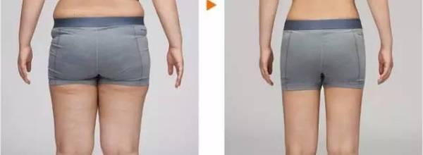 2023年遂寧整形醫(yī)院選擇指南：公立與私立合集