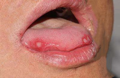 昆明提升法令紋醫(yī)生