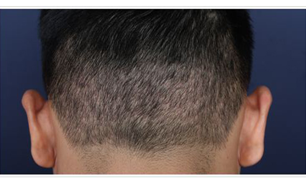 2023年北京豐胸整形排名：綜合評價前五強醫(yī)院揭曉！