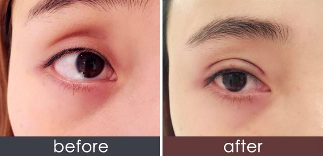 貴陽手術改善臉部松弛醫(yī)生