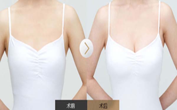 廈門(mén)射頻點(diǎn)陣祛雀斑醫(yī)生