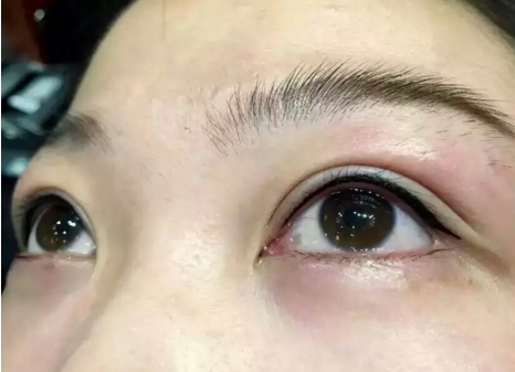 上海隆鼻手術(shù)最佳選擇揭曉！薇琳對玫瑰，網(wǎng)友大調(diào)查揭曉入圍醫(yī)院名單！