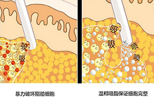 「2023年甘肅省頂尖隆鼻醫(yī)院推薦」