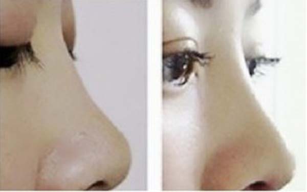 佛山top5家整形醫(yī)院評(píng)選