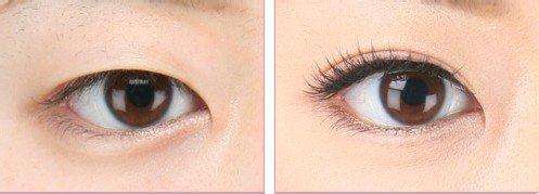 上海專(zhuān)家推薦：首爾麗格、虹橋醫(yī)院為你的祛疤首選！