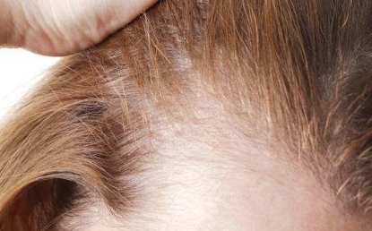 臨沂整形美容醫(yī)院推薦！匯總?cè)瘥悺⑷A美前八，專(zhuān)業(yè)可信！值得信賴(lài)的臨沂整形美容醫(yī)院介紹！