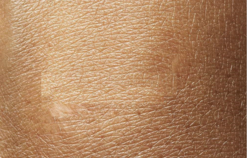 湖南下眼袋去除醫(yī)生