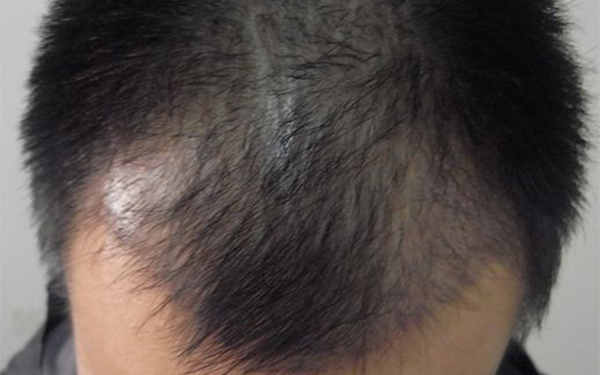 臨沂公立口腔醫(yī)院一覽：多家機(jī)構(gòu)備受贊譽(yù)，靠譜口碑讓您舉措輕松！確保口腔健康，快速選擇最佳！