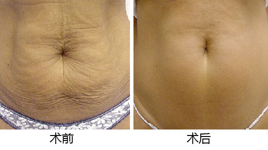 義烏整形醫(yī)院優(yōu)選TOP5，專業(yè)權(quán)威推薦，如何做出準(zhǔn)確選擇？深入了解為上策