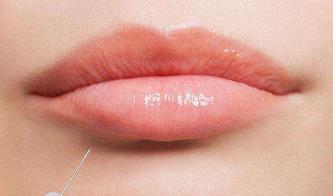 衢州額頭填充脂肪醫(yī)生