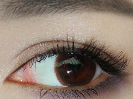 銀川眼角祛皺紋醫(yī)生