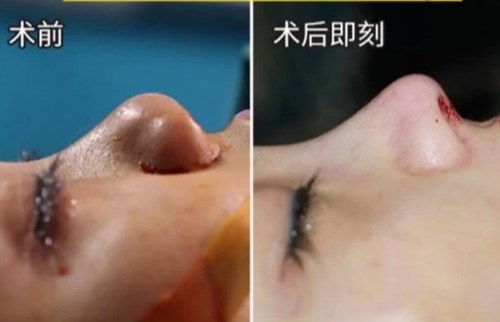 上海膚康：祛斑祛痣首選【口碑6佳】