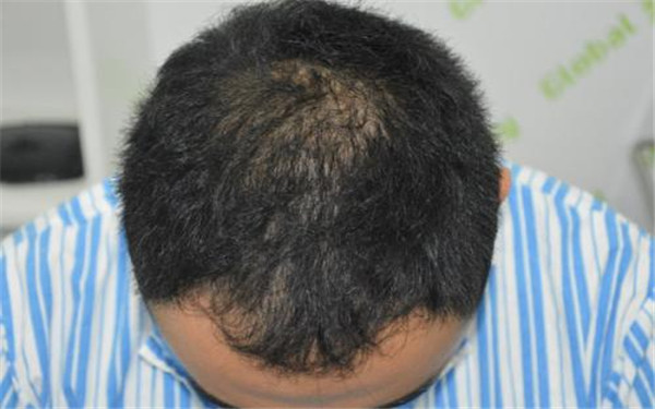 上海著名整形醫(yī)院推薦：終結(jié)疤痕困擾的好去處！