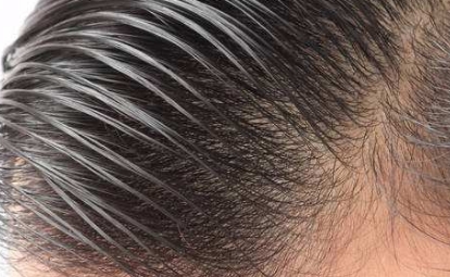 【2023年最佳整容醫(yī)院】重慶地區(qū)前十強(qiáng)推薦，不容錯(cuò)過(guò)！點(diǎn)擊收藏參考！