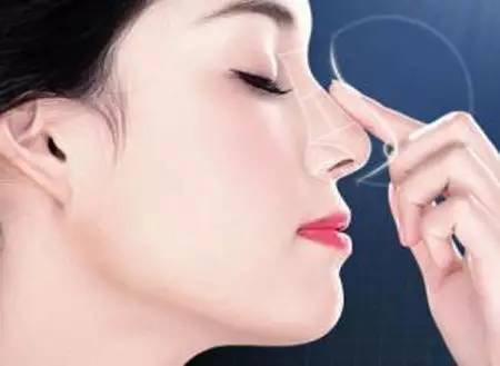 荊州玻尿酸額頭紋填充醫(yī)生