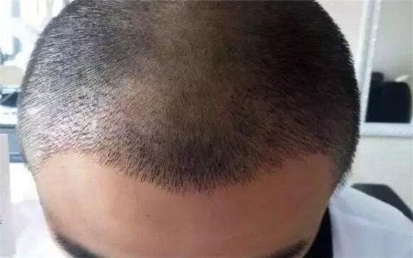 上海牙齒整形公立醫(yī)院一覽：呵護(hù)您牙齒健康，這里應(yīng)是您首選！