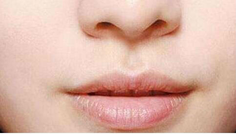 長沙光電治療打眉間紋醫(yī)生