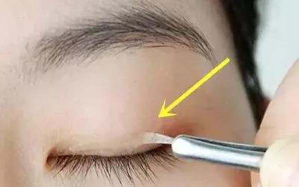 【濱州面部吸脂】【哪家醫(yī)院好】推薦6家供選擇