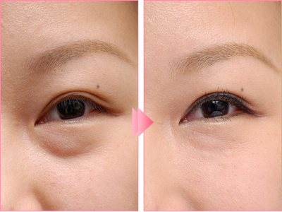 上海整形醫(yī)院最佳選擇！潔銘、伊萊美、時(shí)光、藝星等實(shí)力醫(yī)院推薦！