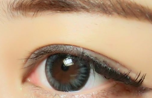 廣州鐳射激光祛靜態(tài)紋醫(yī)生