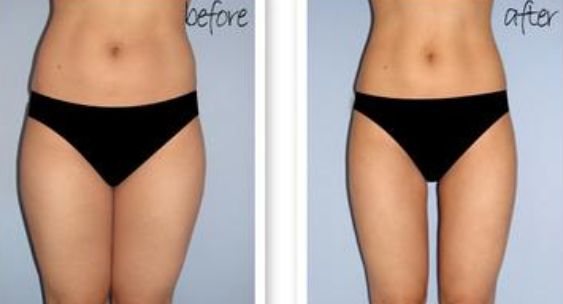 揚州上眼瞼注射填充醫(yī)生