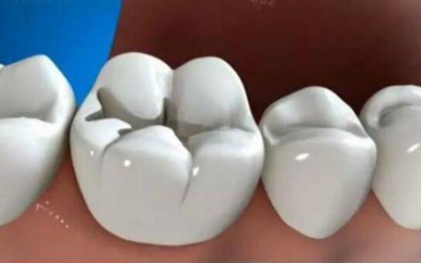 南京口腔醫(yī)院大全：一個問題解決口腔的終極名單！