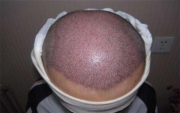 合肥整形醫(yī)院大比拼，公立與私立醫(yī)美斗法，哪家成為你的首選