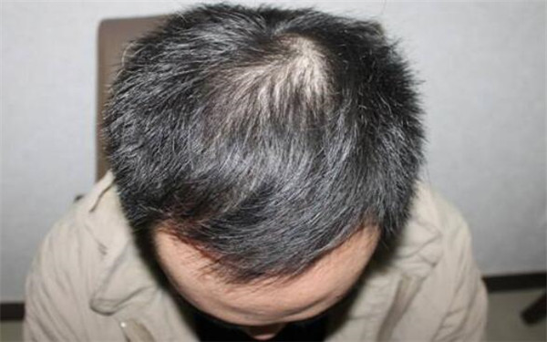 南昌三甲醫(yī)院全面盤點(diǎn)：專業(yè)美容整形醫(yī)院推薦，趕緊了解一下！