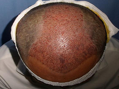 南通最佳祛斑醫(yī)院推薦！康美醫(yī)療第二，維多利亞給力薦！