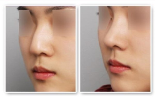 南京紋身去除醫(yī)院大全：幫助您恢復(fù)光滑肌膚的專業(yè)機(jī)構(gòu)！