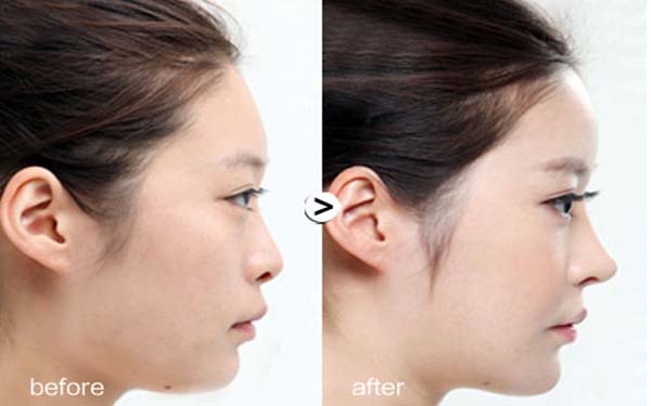 北京眼袋手術(shù)醫(yī)院匯總：前五強(qiáng)推薦，不容錯過！