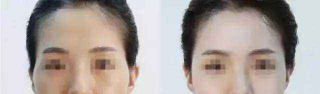 蘭州頂級(jí)整容醫(yī)院排行榜：讓你安心整形，保障你的雙眼皮手術(shù)結(jié)果！