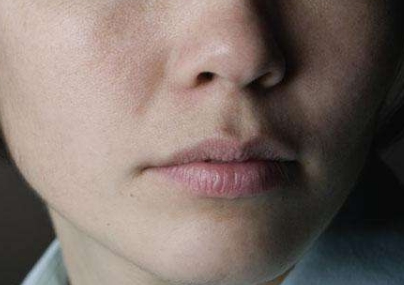 西安光子嫩膚脫毛醫(yī)生