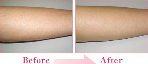 廈門綜合整形醫(yī)院排名：專業(yè)玻尿酸注射手術前七強！