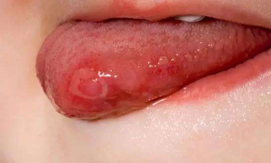 大連耳輪缺損修復(fù)醫(yī)生