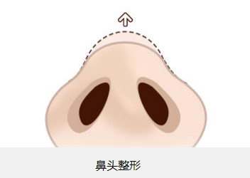 北京植眉醫(yī)院推薦：高新及新生，專業(yè)醫(yī)護(hù)技藝令人贊嘆！