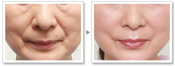 南充皮膚修復中心：精心挑選的6家洗紋身醫(yī)院，達芬奇、韓美榜上集結