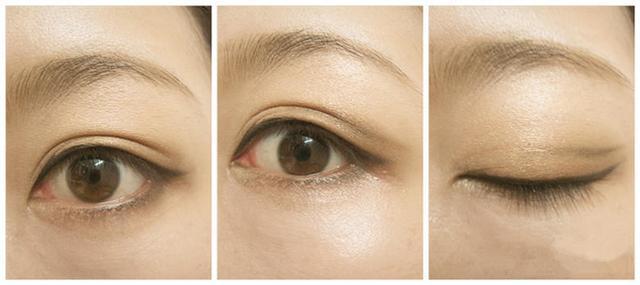 北京治療眼袋效果最好的公立醫(yī)院排行榜發(fā)布！頂級(jí)醫(yī)療機(jī)構(gòu)全在列