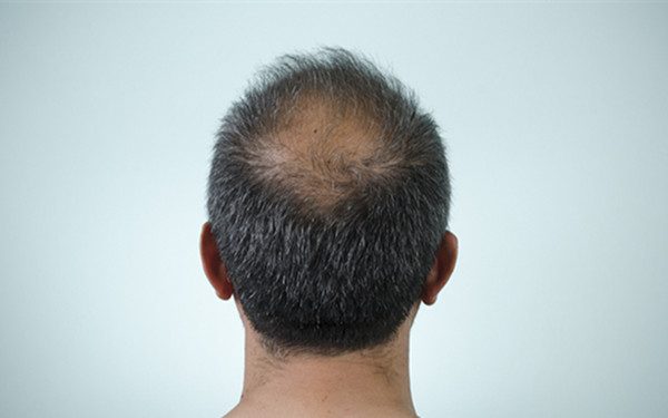 北京隆鼻醫(yī)院推薦排行榜：僅限前五名，不容錯過