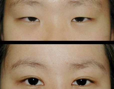 頭五！眼霞醫(yī)美奪魁，藍(lán)溪和悅色重要三強(qiáng)，輿論瘋傳！