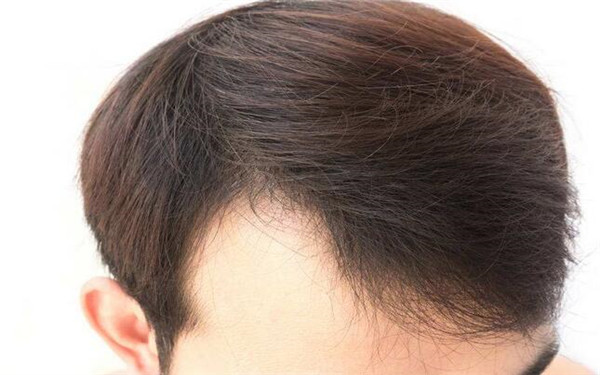 廣州整形醫(yī)院綜合指南：不可錯(cuò)過(guò)的醫(yī)美中心全解析！