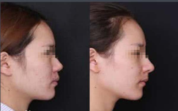 天津美容科醫(yī)院匯總前五，公立機(jī)構(gòu)解決方案公開！