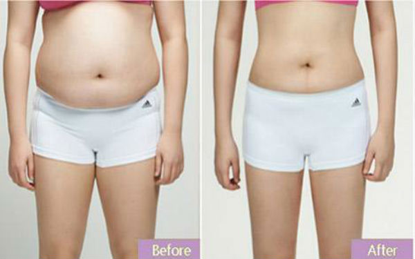 常德眼袋手術(shù)推薦排名TOP10！公私醫(yī)院詳細(xì)對(duì)比，看看你選對(duì)了沒有