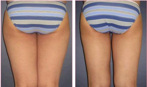 天津治療疤痕疙瘩醫(yī)院排行榜：文怡、坤如瑪麗引人矚目！