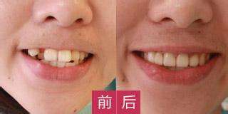 哪家醫(yī)院適合進(jìn)行磨骨手術(shù)？江城和美立方廣受網(wǎng)友推崇！