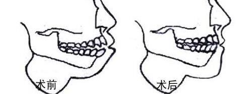 太原祛疤醫(yī)院推薦：多家專業(yè)機(jī)構(gòu)為您帶來(lái)有效祛疤方案!