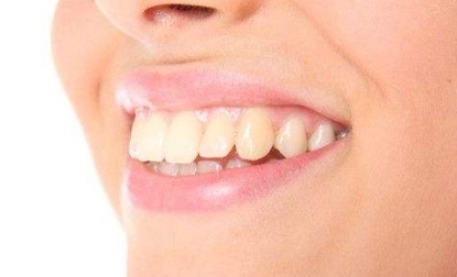 威海整形醫(yī)院評(píng)價(jià)推薦：當(dāng)?shù)赜锌诮员腡op名單，歡迎考慮威海整形之旅！