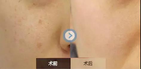 葫蘆島干細(xì)胞祛疤印醫(yī)生