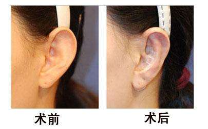 山東頂級(jí)整容名醫(yī)盤點(diǎn)，專家推薦詳細(xì)資料一覽！